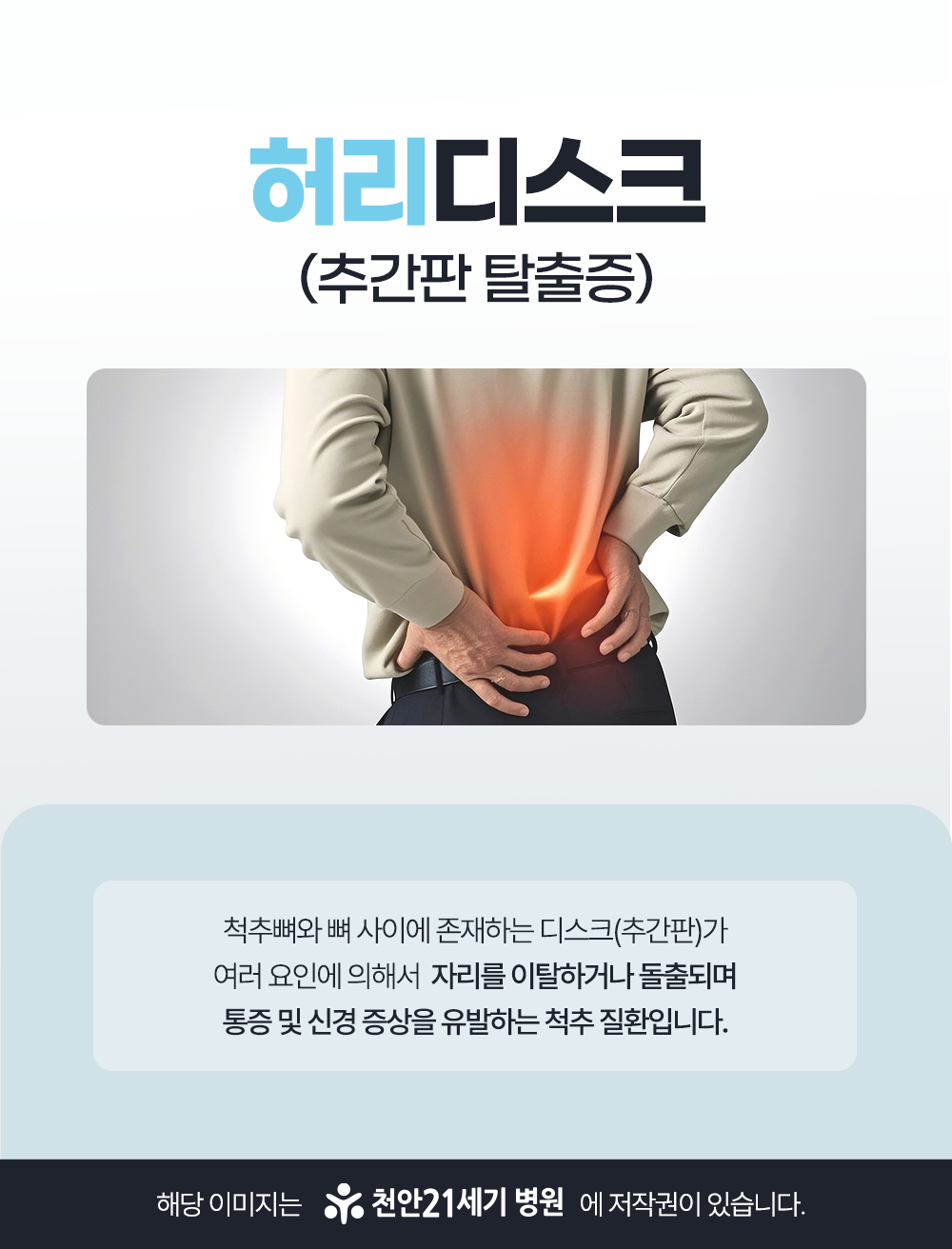 천안21세기병원 허리디스크