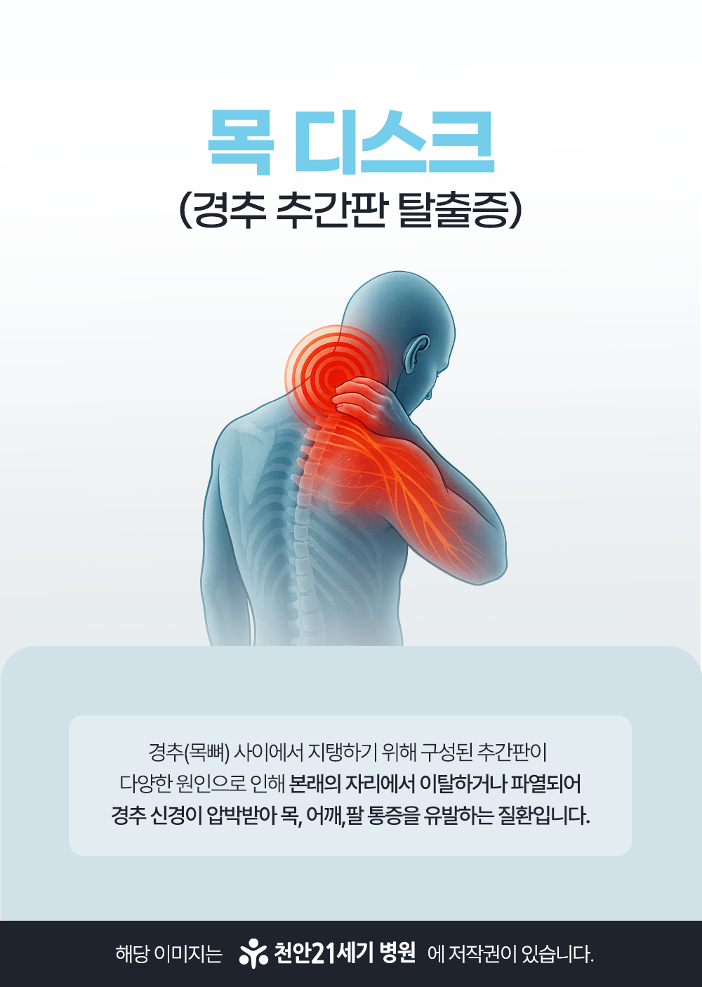 천안21세기병원 천안21세기 목디스크